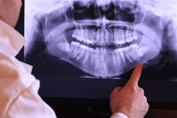 Best Emergency Broken Tooth Repair in Harrisville, WV