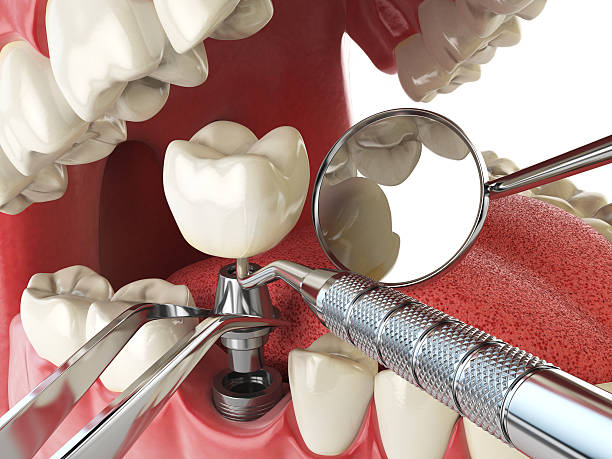Best Weekend Emergency Dentist in Harrisville, WV